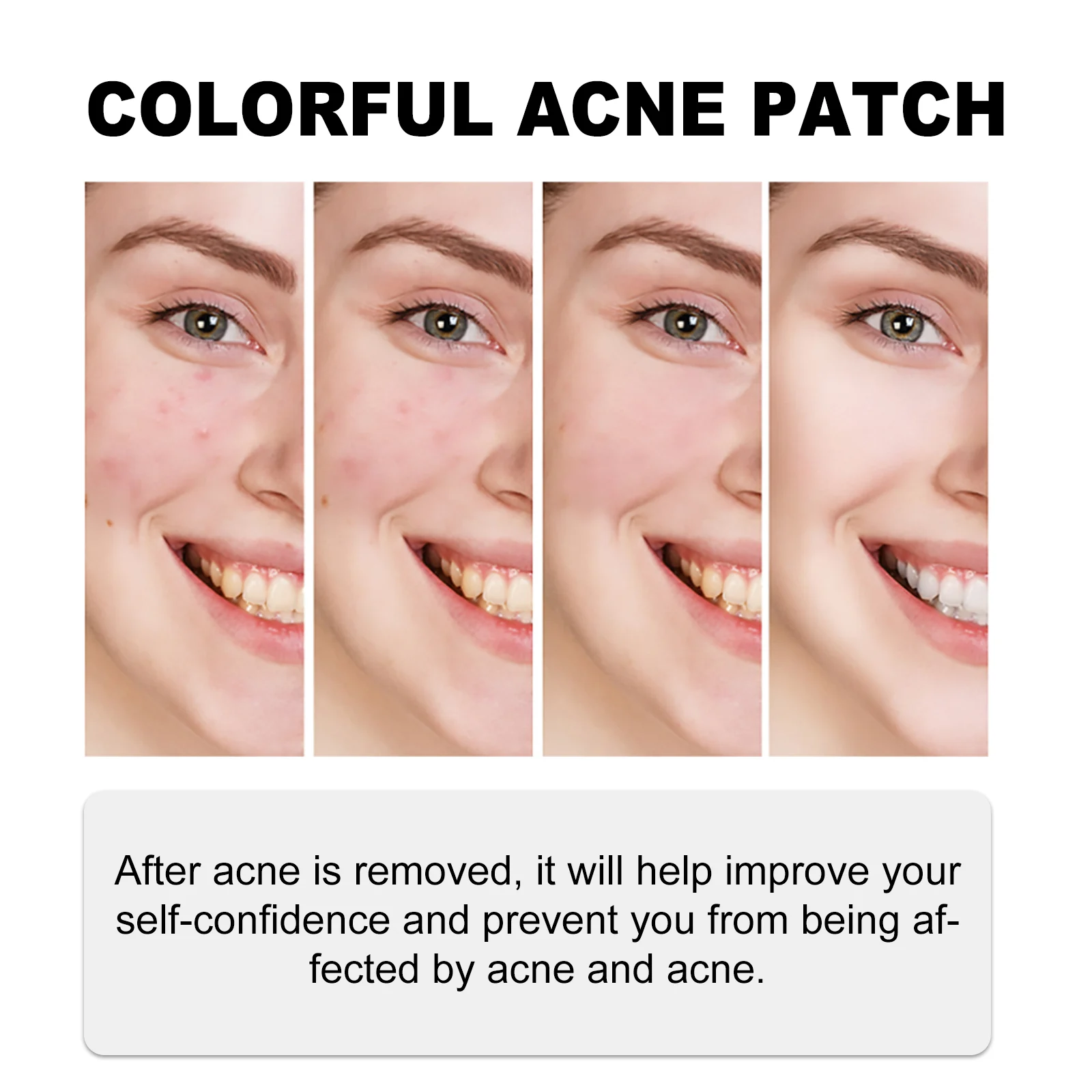 West Month Blue Acne Patches with Tea Tree & Hyaluronic Acid for Fast Gentle Care 8 blue acne patches wes 8mv7v7fa desc 8