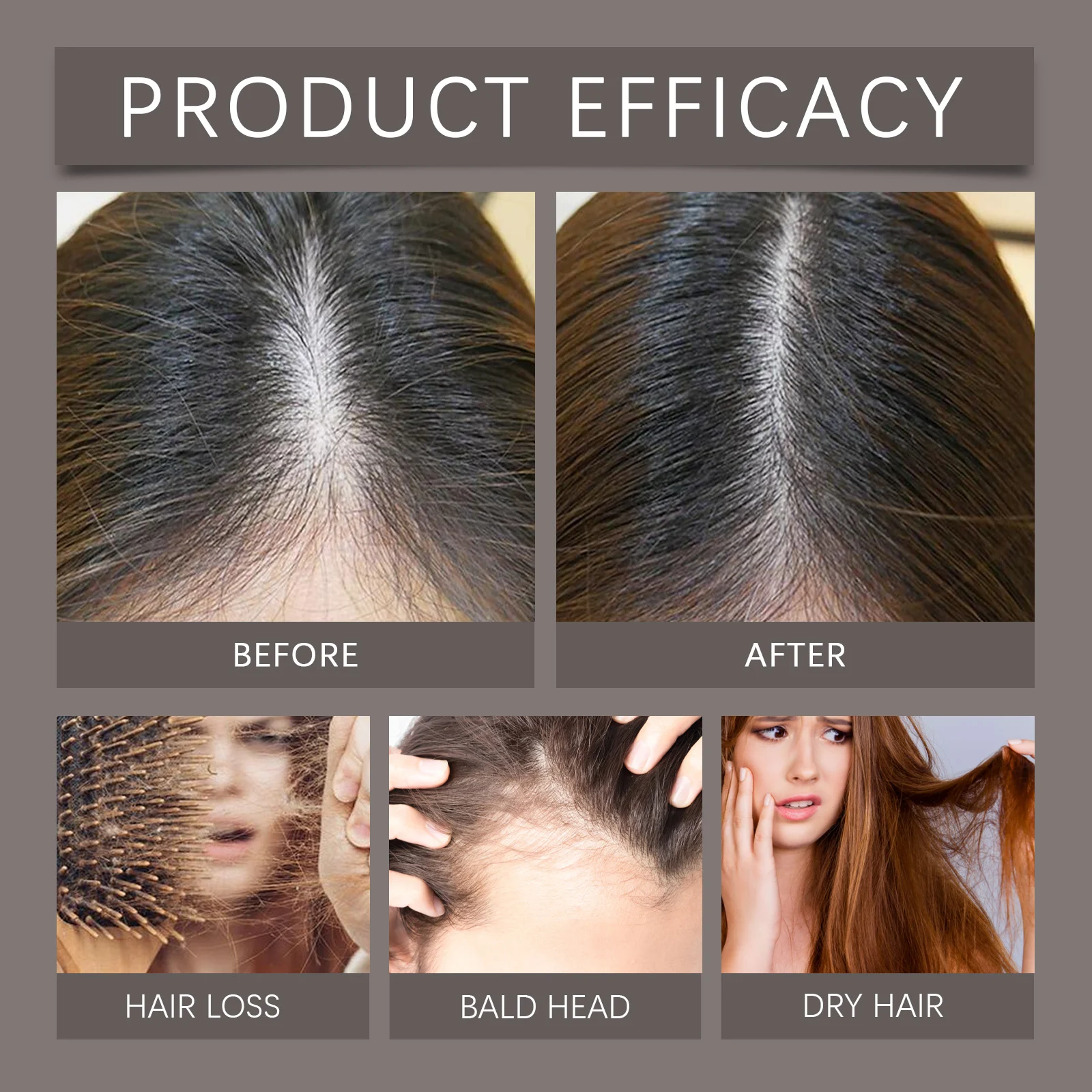 Caffeine Hair Growth Oil 50ml for Hair Loss Repair and Scalp Nourishment 9 caffeine hair growth oil 50ml wes swgjcpr4 desc 9