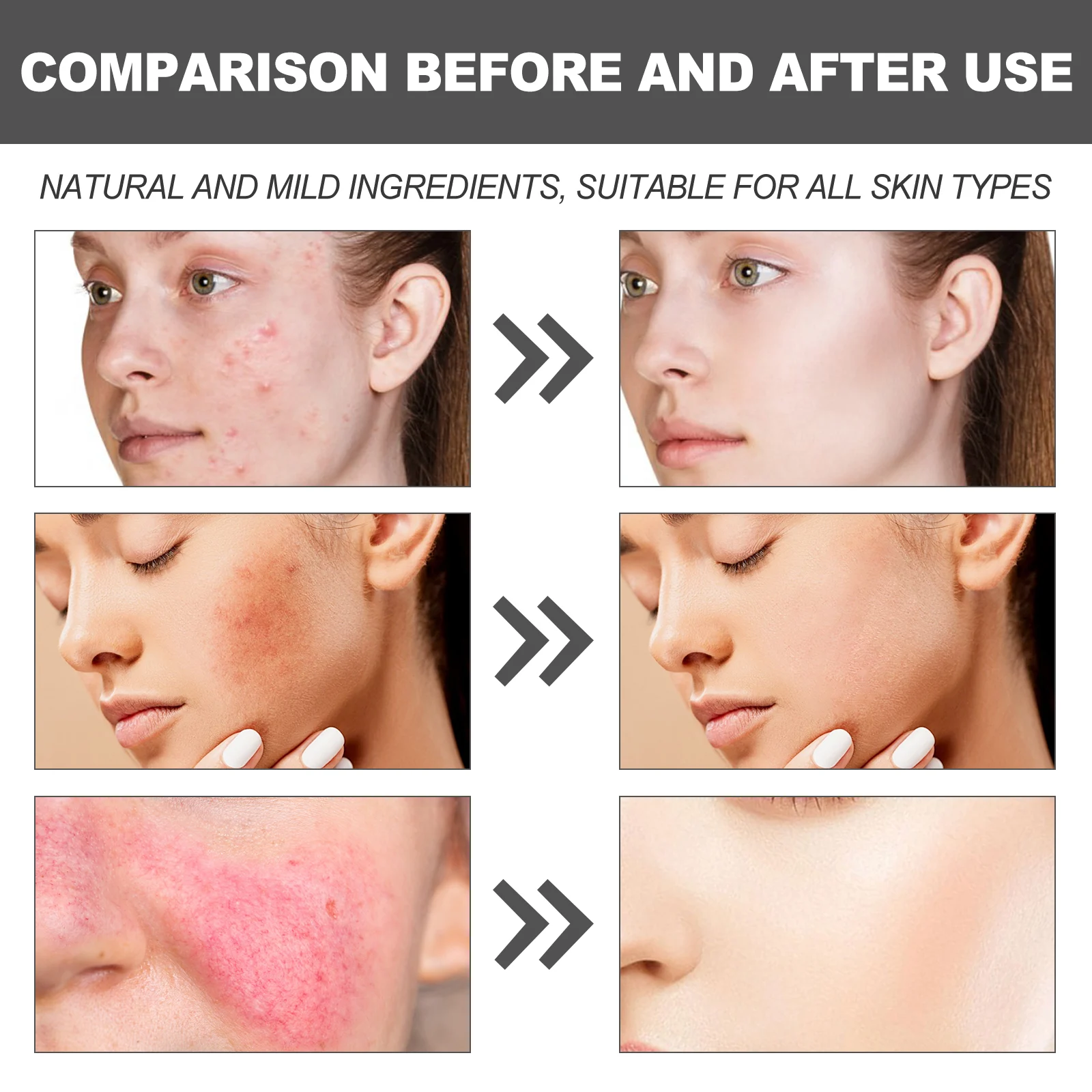 Centella Asiatica Moisturizing Cream 60ml for Brightening, Hydration & Wrinkle Care 9 centella asiatica moisturizing cream 60ml wes z5zg6yf8 desc 9