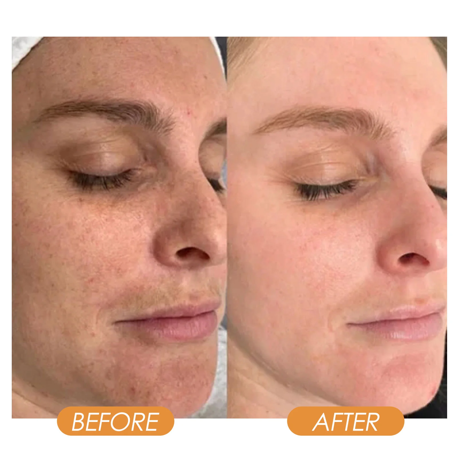West Month Soluble Collagen Eye Film & Tightening Facial Spray 50ml 9 collagen eye film facial spray wes 7pmz5k4n desc 9