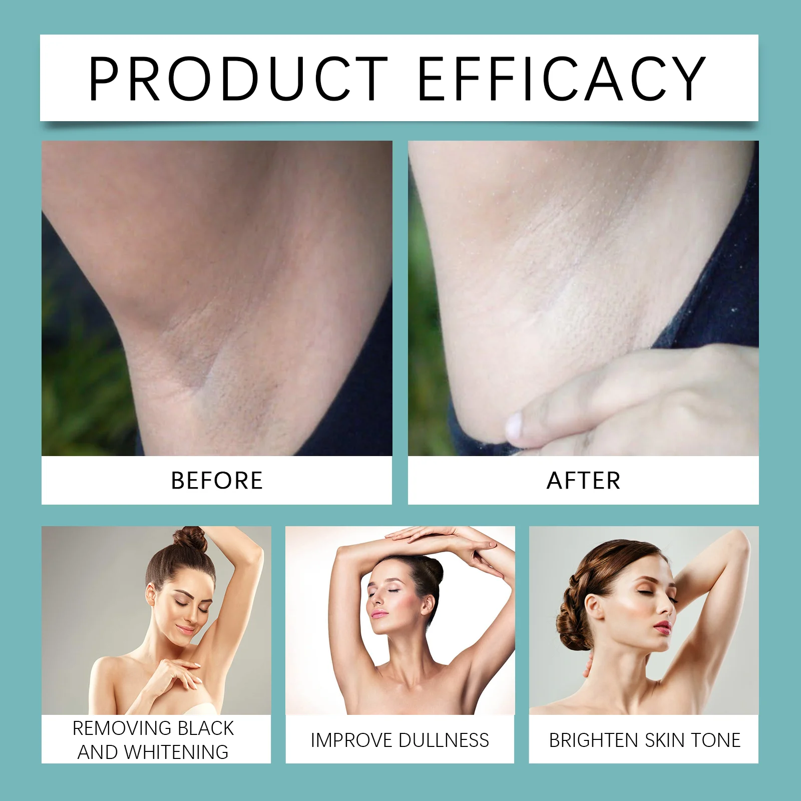 Dark Spot Liquid for Thighs 100ml with Retinol & Lactic Acid, Brightening & Nourishing Body Lotion for Inner Thighs 9 dark spot liquid for thighs brightening body lotion 100ml wes 2jdeaydx desc 9