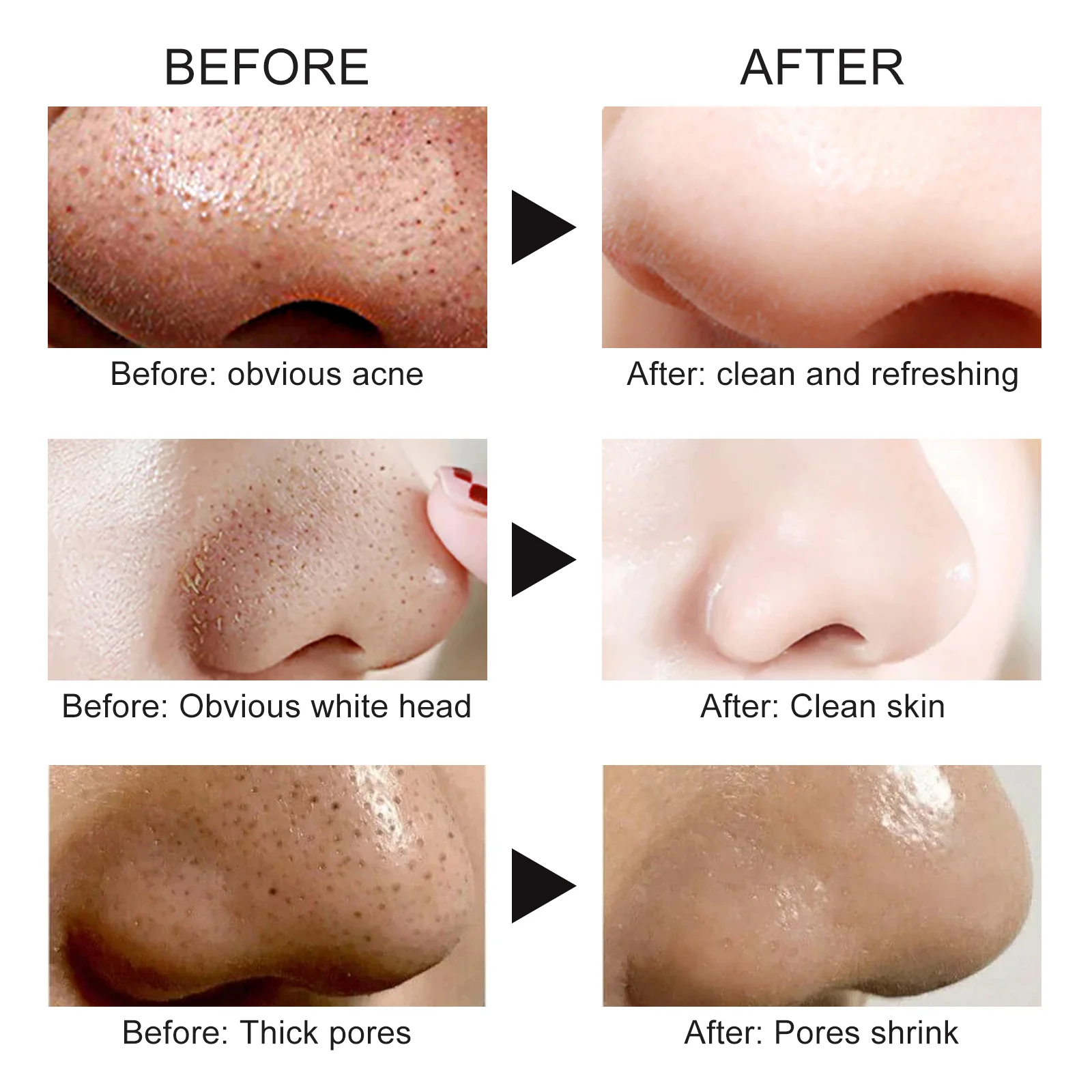 West Month Deep Cleansing Nose Pore Strips for Blackhead Removal 11 deep cleansing nose pore strips wes c3k8qqtp desc 11