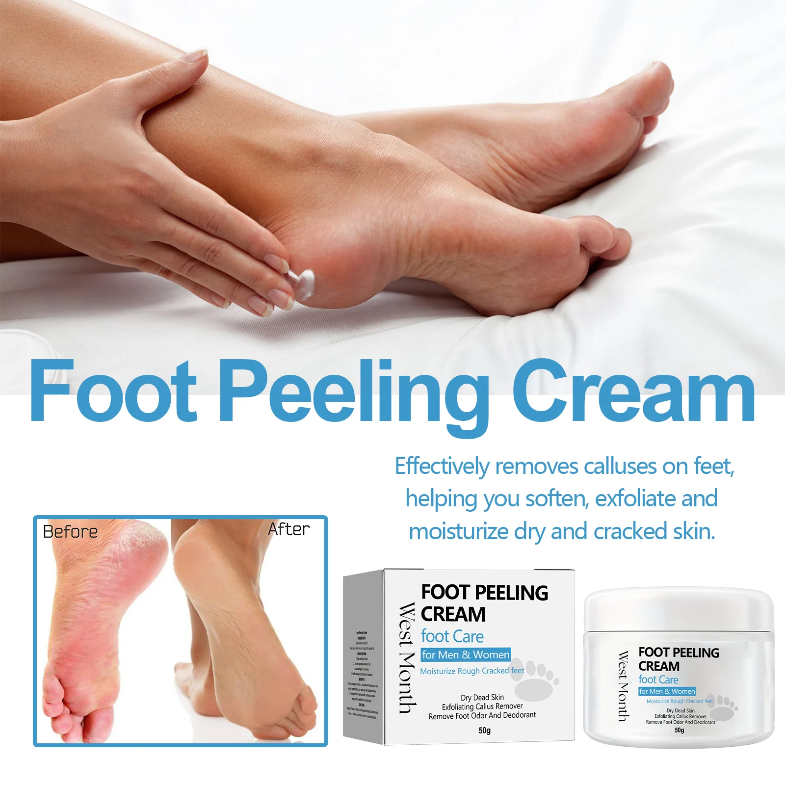 Foot Peeling Cream 50g - Repair, Moisturize & Remove Calluses for Soft Feet 7 foot peeling cream 50g repair moisturize callus remover wes m2p26we5 desc 7