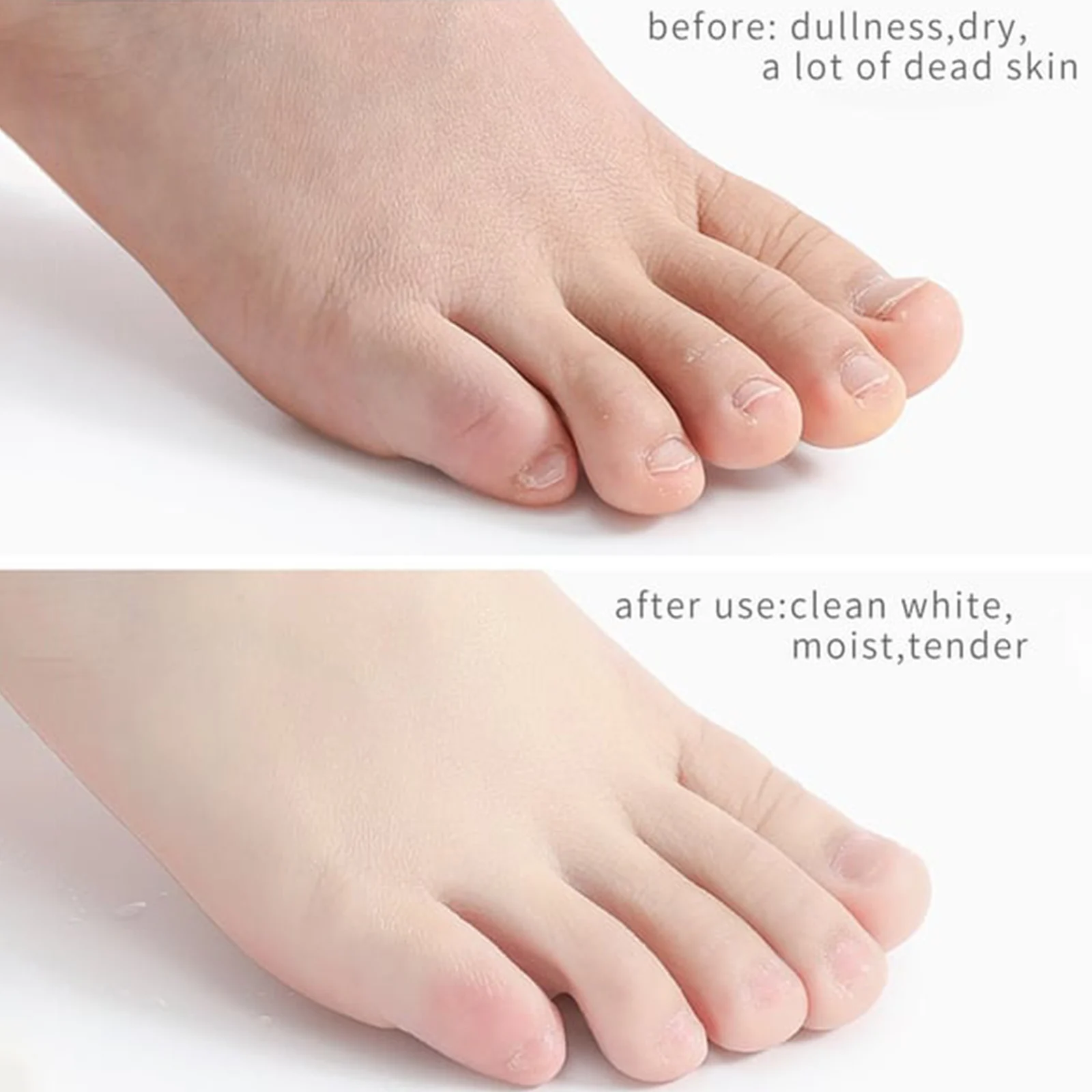 Foot Peeling Spray for Cracked Heels and Callus Removal Moisturizing Exfoliator 50ml 9 foot peeling spray cracked heels callus remover 50ml wes pnxm8pb6 desc 9