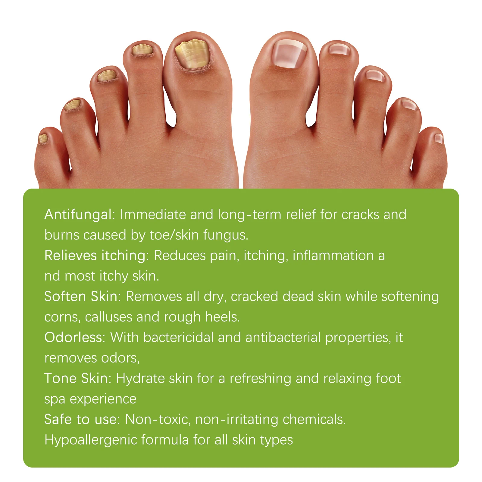 West Month Ginger Foot Soak Tablets for Toenail Fungus, Cracked Feet & Odor 3 ginger foot soak tablets wes cdrfgzjz desc 3