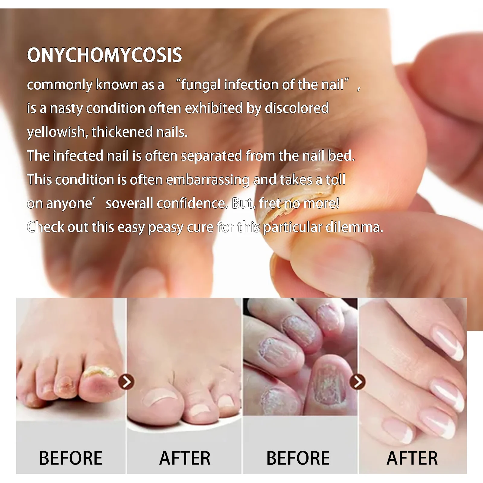 West Month Ginger Foot Soak Tablets for Toenail Fungus, Cracked Feet & Odor 4 ginger foot soak tablets wes cdrfgzjz desc 4