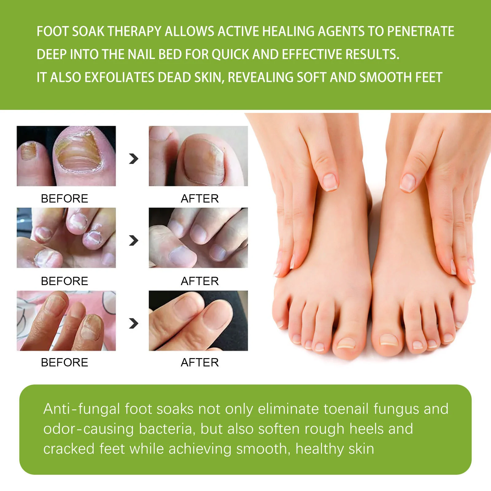 West Month Ginger Foot Soak Tablets for Toenail Fungus, Cracked Feet & Odor 7 ginger foot soak tablets wes cdrfgzjz desc 7