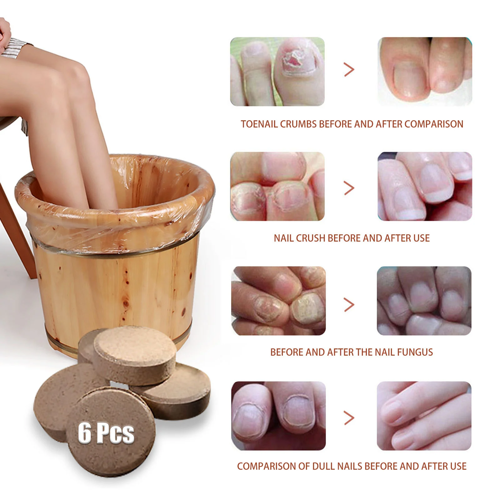 West Month Ginger Foot Soak Tablets for Toenail Fungus, Cracked Feet & Odor 8 ginger foot soak tablets wes cdrfgzjz desc 8