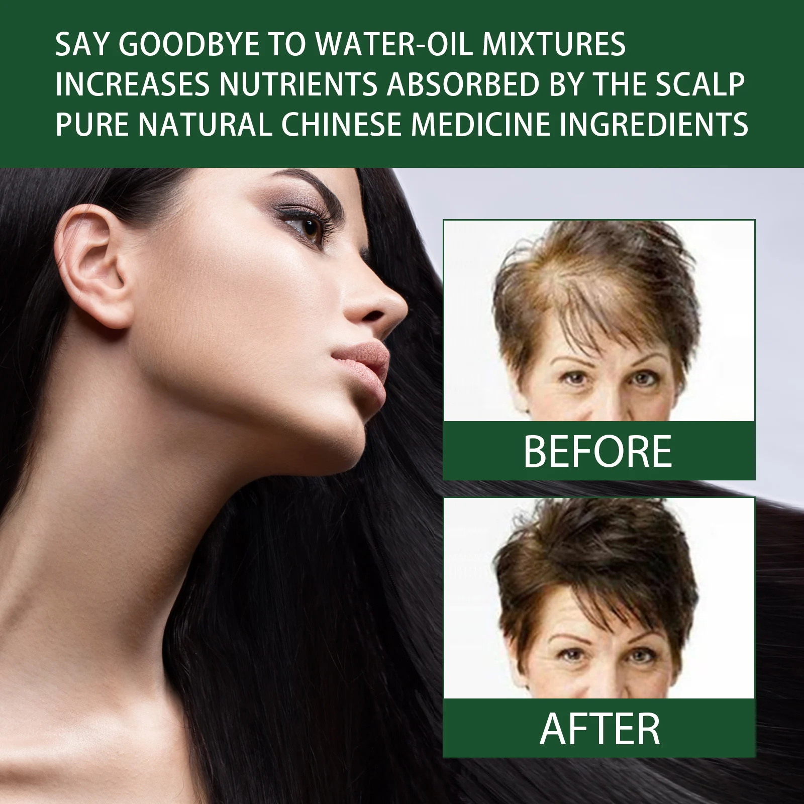 Ginger Hair Growth Serum 30ml with He Shou Wu & Ginseng for Hair Loss Prevention & Scalp Nourishment 11 ginger hair growth serum 30ml wes s7fh4p4h desc 11
