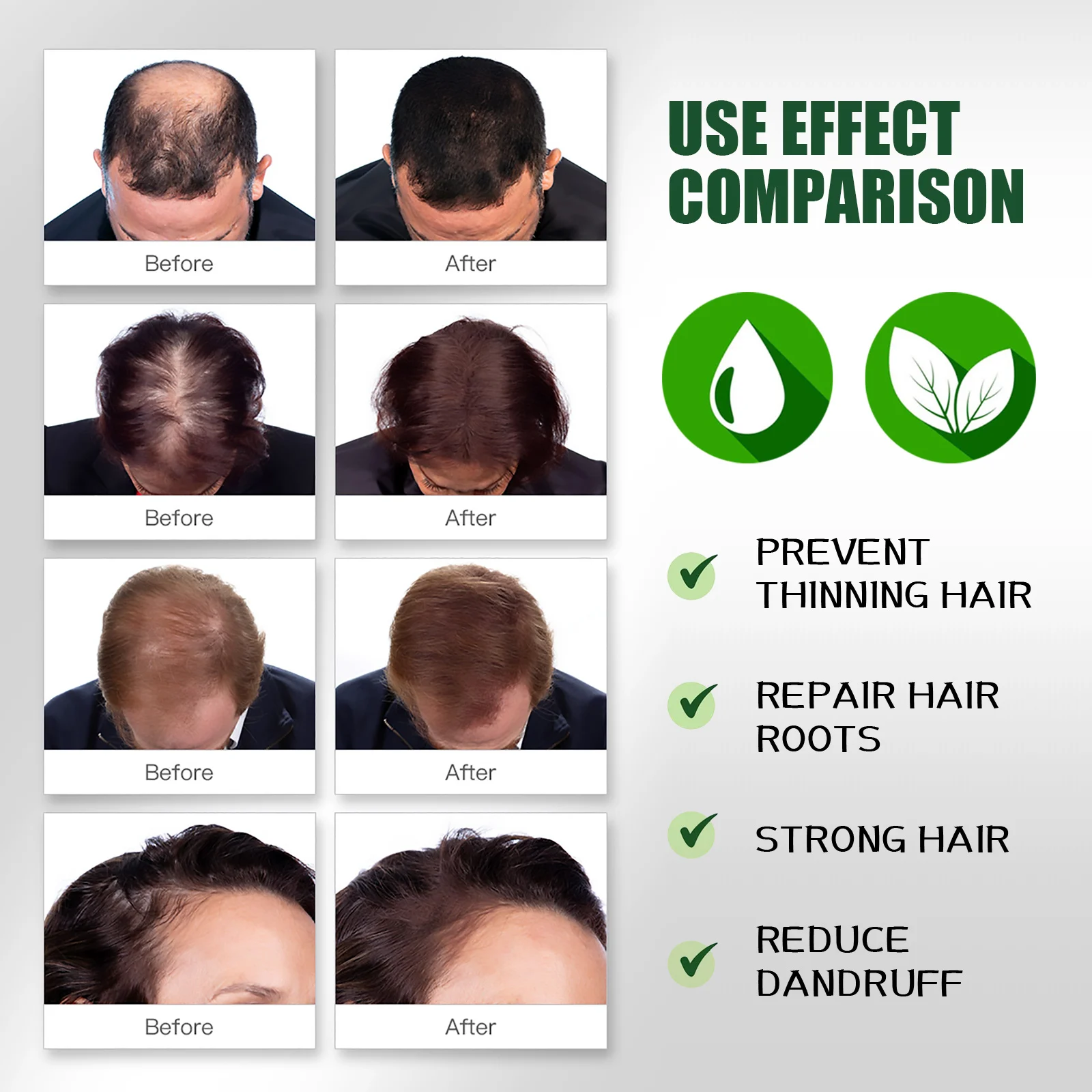 Ginger Hair Growth Serum 30ml with He Shou Wu & Ginseng for Hair Loss Prevention & Scalp Nourishment 7 ginger hair growth serum 30ml wes s7fh4p4h desc 7