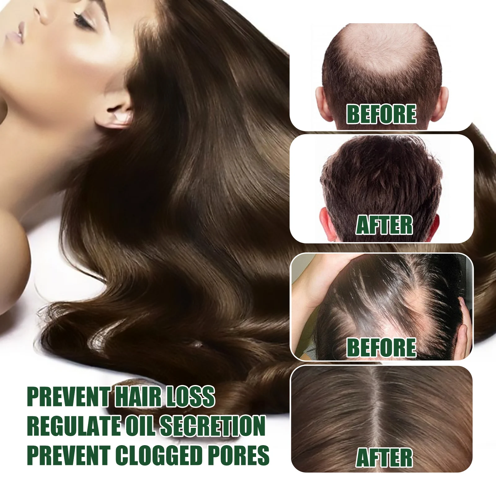 Ginger Hair Growth Serum 30ml with He Shou Wu & Ginseng for Hair Loss Prevention & Scalp Nourishment 9 ginger hair growth serum 30ml wes s7fh4p4h desc 9