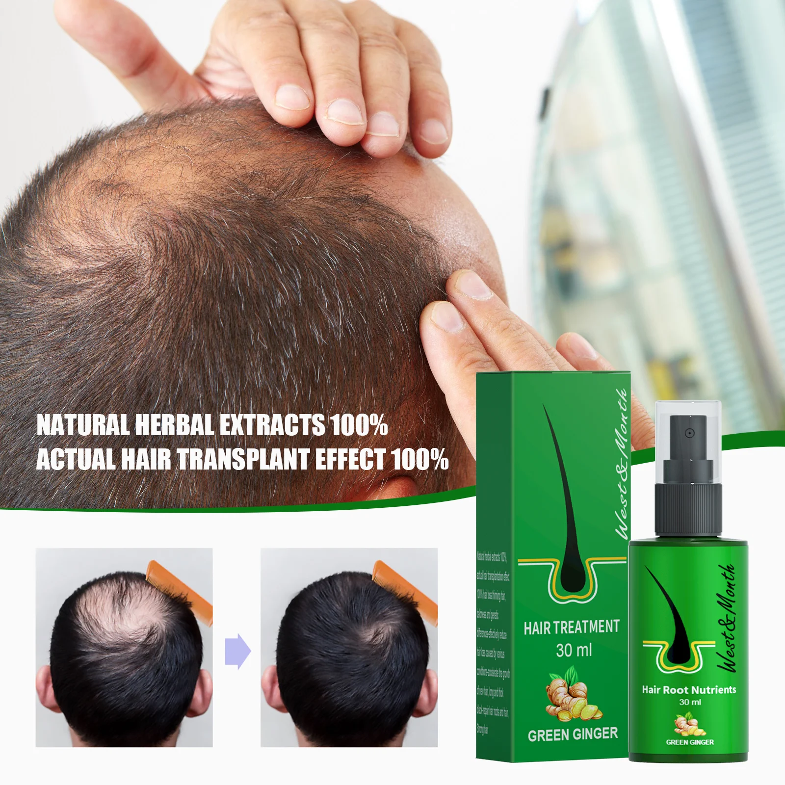 Ginger Hair Growth Spray 30ml Hair Treatment for Thinning Hair & Scalp Nourishment 1 ginger hair growth spray 30ml wes 43bzc6h8 desc 1