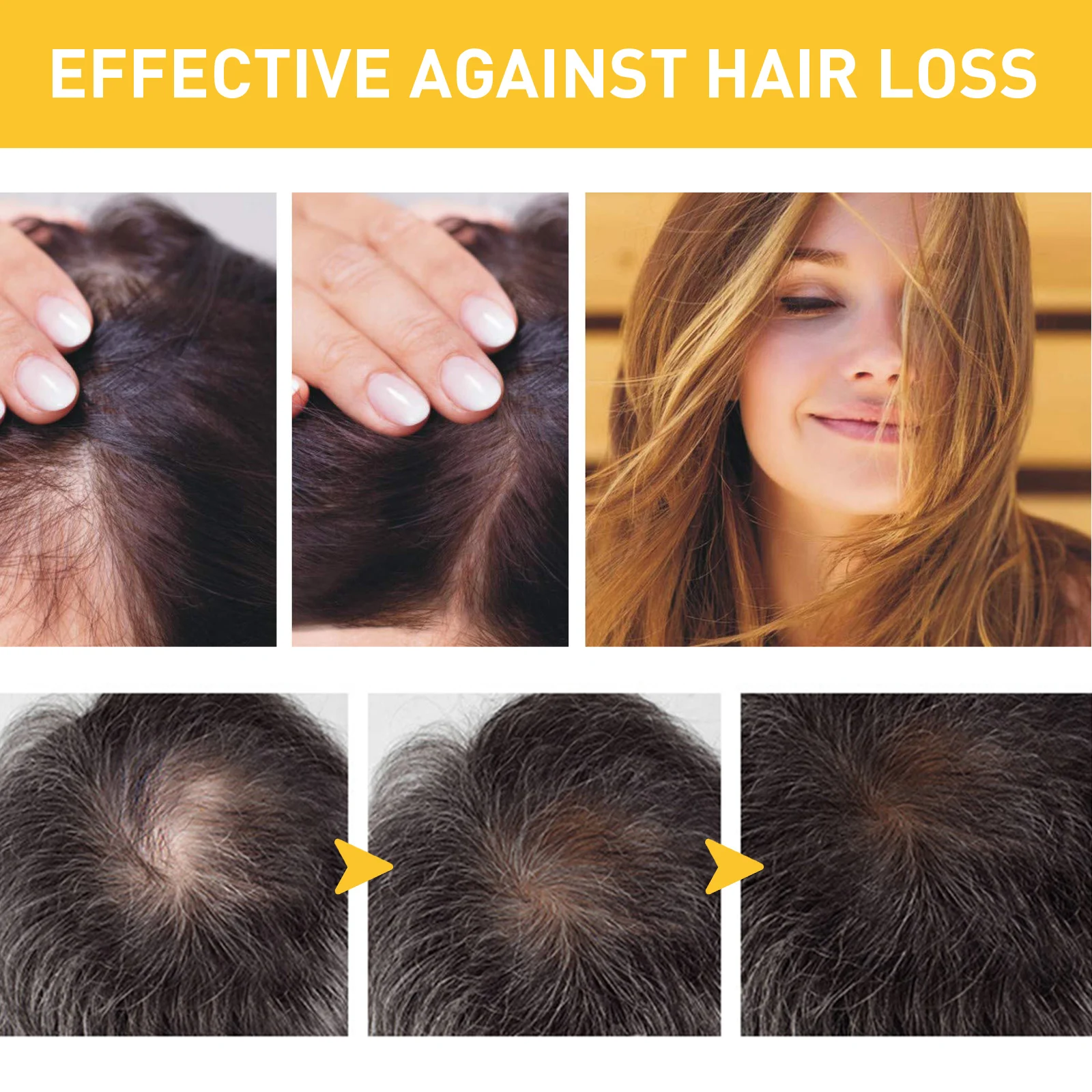 Ginger Hair Loss Treatment Cream 30g for Hair Growth & Scalp Health 6 ginger hair loss treatment cream 30g wes yy4fdkhf desc 6