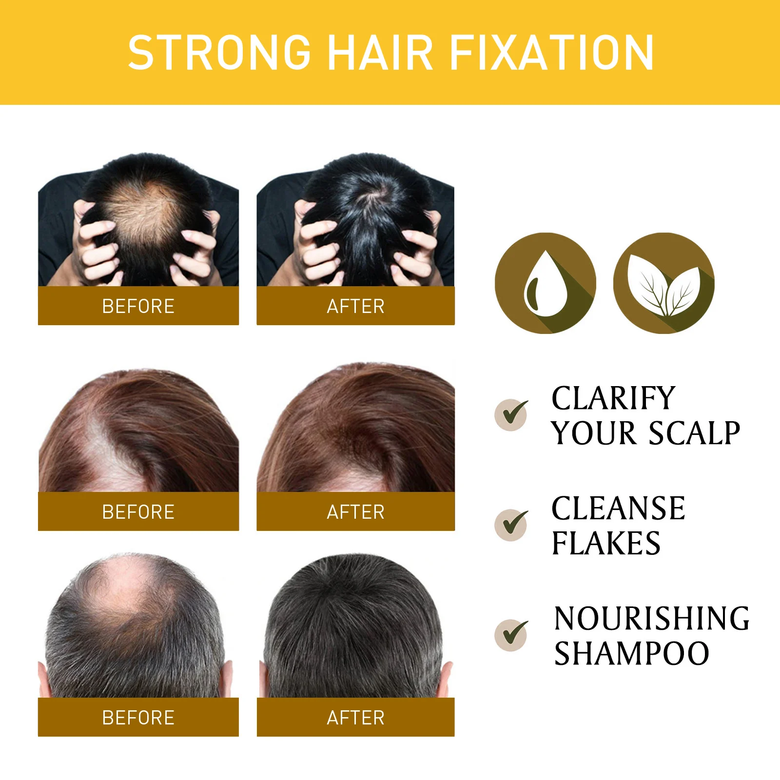 Ginger Hair Loss Treatment Cream 30g for Hair Growth & Scalp Health 8 ginger hair loss treatment cream 30g wes yy4fdkhf desc 8