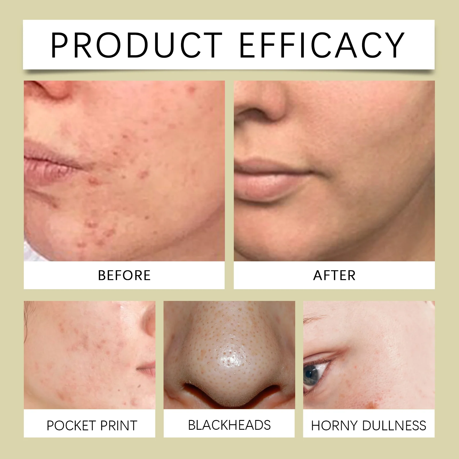 Glycolic Acid Toner 7% Solution 100ml for Blemish & Anti-Aging Treatment 9 glycolic acid toner 7percent solution 100ml wes 74atxv4r desc 9