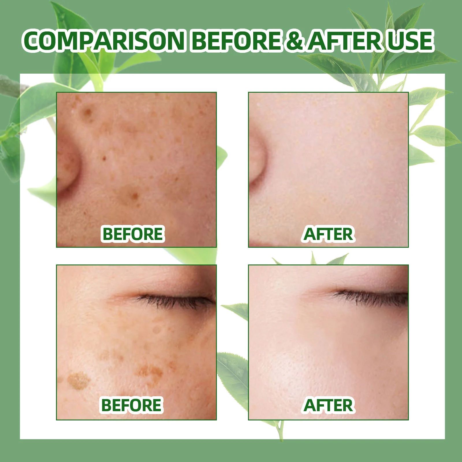 West Month Green Tea Anti-Freckle Whitening Toner 60ml Brighten Skin Dark Spots 9 green tea anti freckle toner wes 8jb5bgjh desc 9