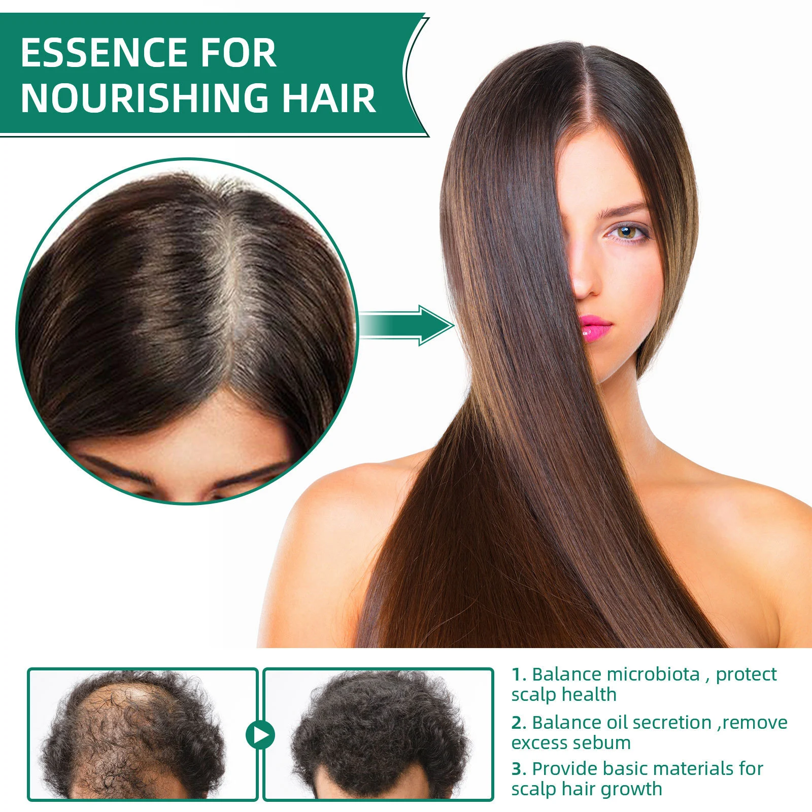 West Month Oriental Arborvitae Herbal Hair Tonic - Reduce Hair Loss & Nourish Scalp 60ml 5 herbal hair tonic growth wes yrfpvwc3 desc 5