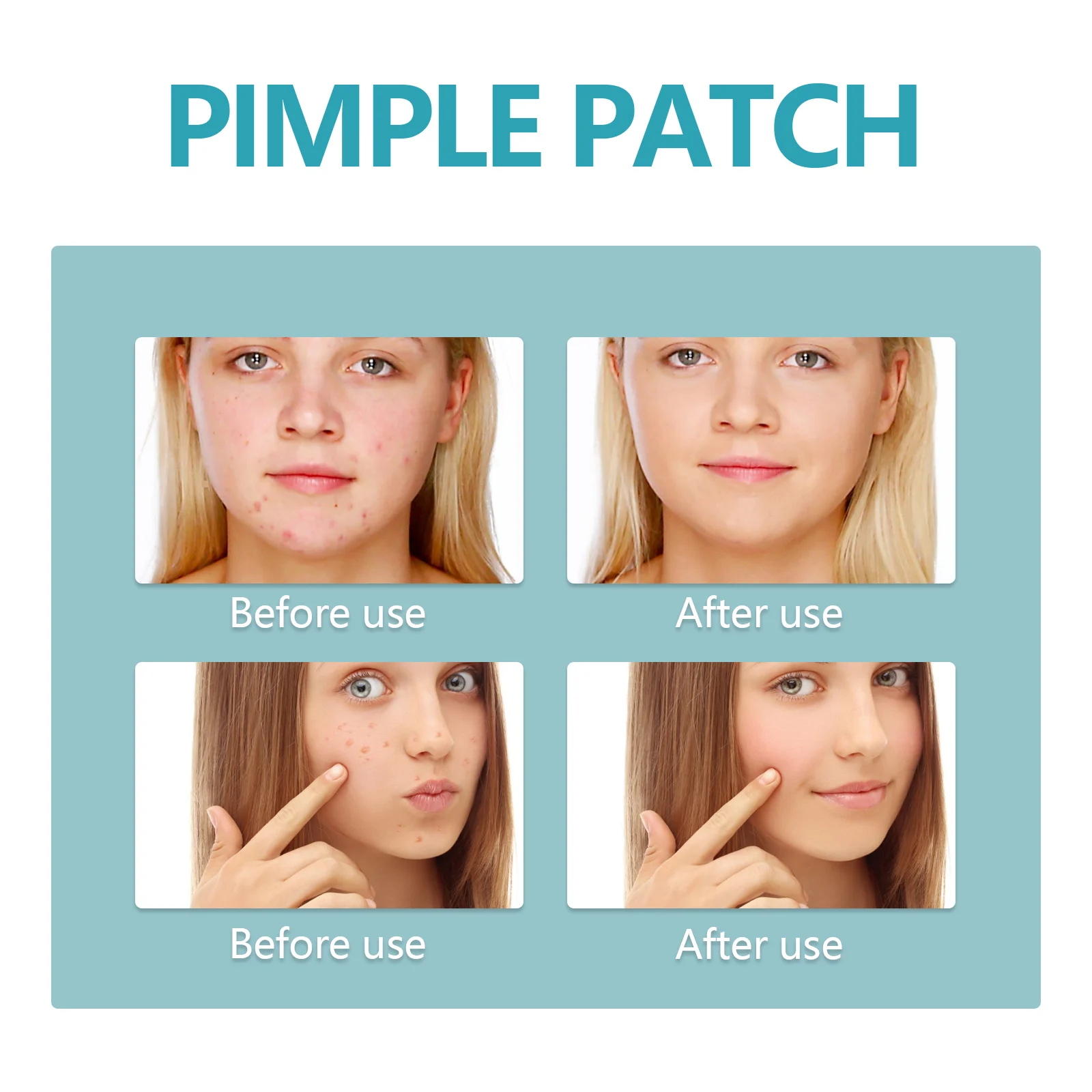 Hydrocolloid Acne Patches for Pimples, Invisible & Waterproof Healing Pimple Spot Treatment 216pcs 7 hydrocolloid acne patches pimple healing spot treatment 216pcs wes g3cryzpe desc 7