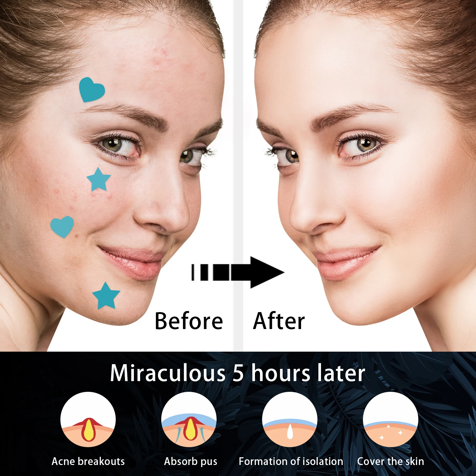 Hydrocolloid Acne Patches for Pimples, Invisible & Waterproof Healing Pimple Spot Treatment 216pcs 8 hydrocolloid acne patches pimple healing spot treatment 216pcs wes g3cryzpe desc 8