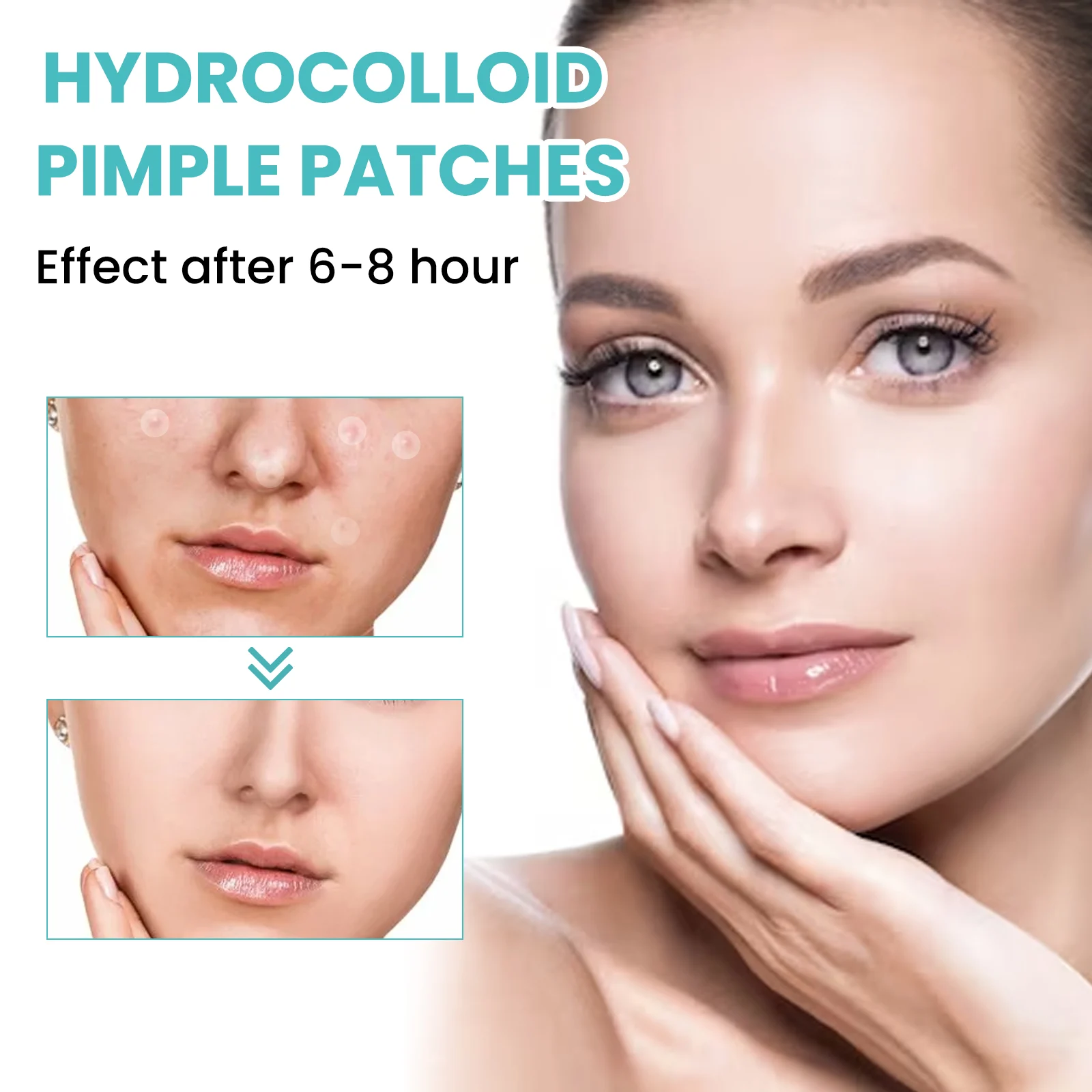 West Month Pimple Patches 300pcs Hydrocolloid Invisible Acne Healing 6 hydrocolloid acne pimple patches wes btfhejgn desc 6