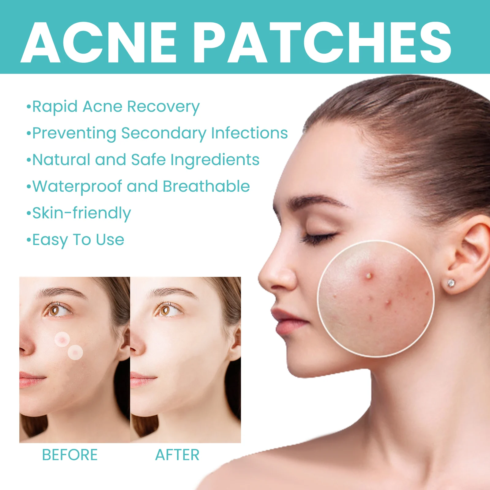 West Month Pimple Patches 300pcs Hydrocolloid Invisible Acne Healing 9 hydrocolloid acne pimple patches wes btfhejgn desc 9