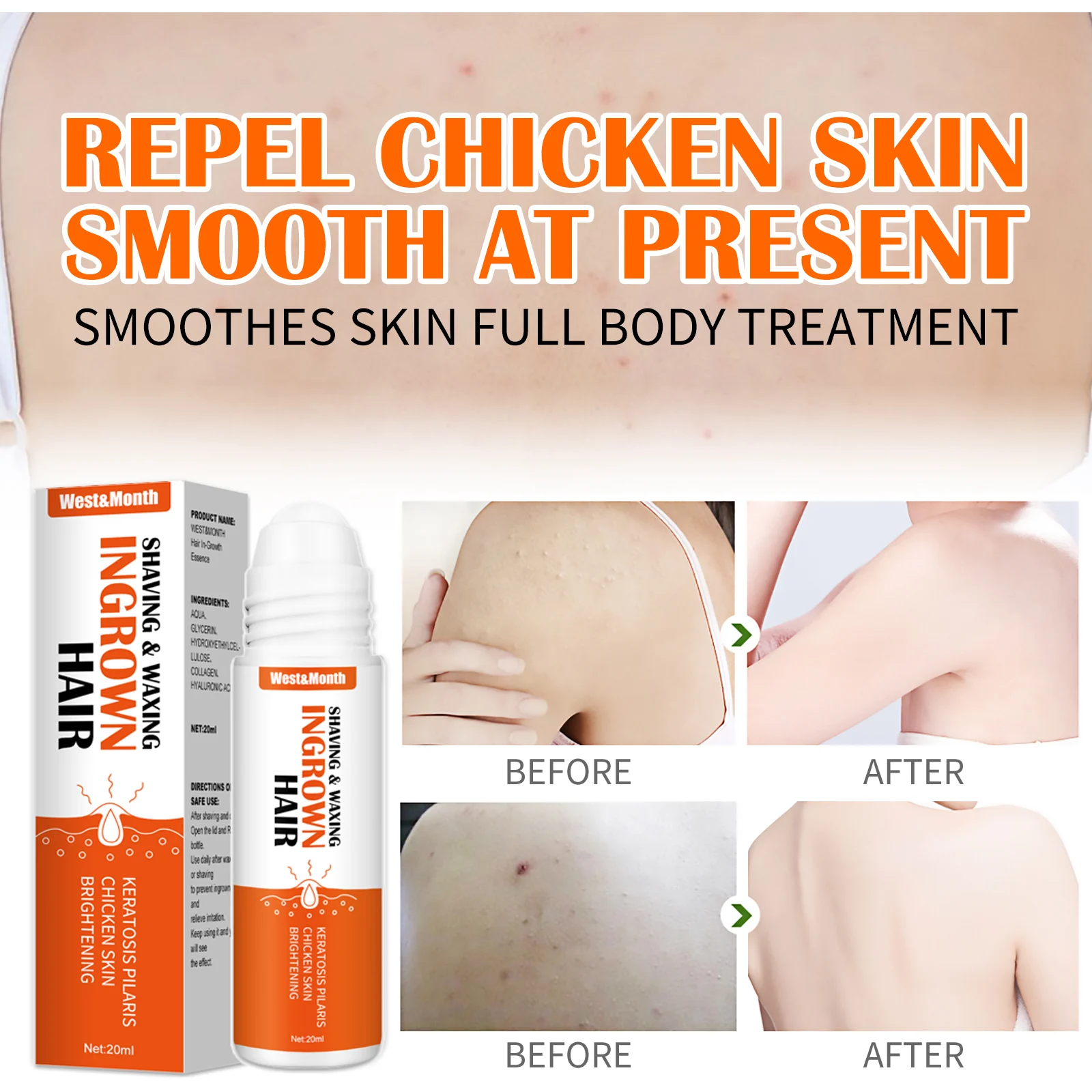 Ingrown Hair Roll-On Essence 20ml for Post-Shaving & Waxing, Prevents Razor Bumps & Brightens Skin 6 ingrown hair roll on essence 20ml wes t4272y8r desc 6