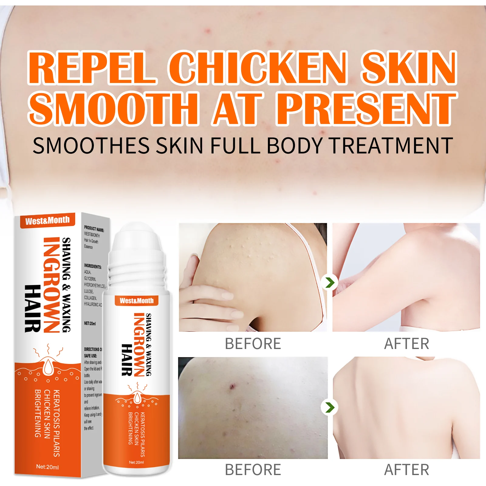 Ingrown Hair Roll-On Essence 20ml for Post-Shaving & Waxing, Prevents Razor Bumps & Brightens Skin 8 ingrown hair roll on essence 20ml wes t4272y8r desc 8