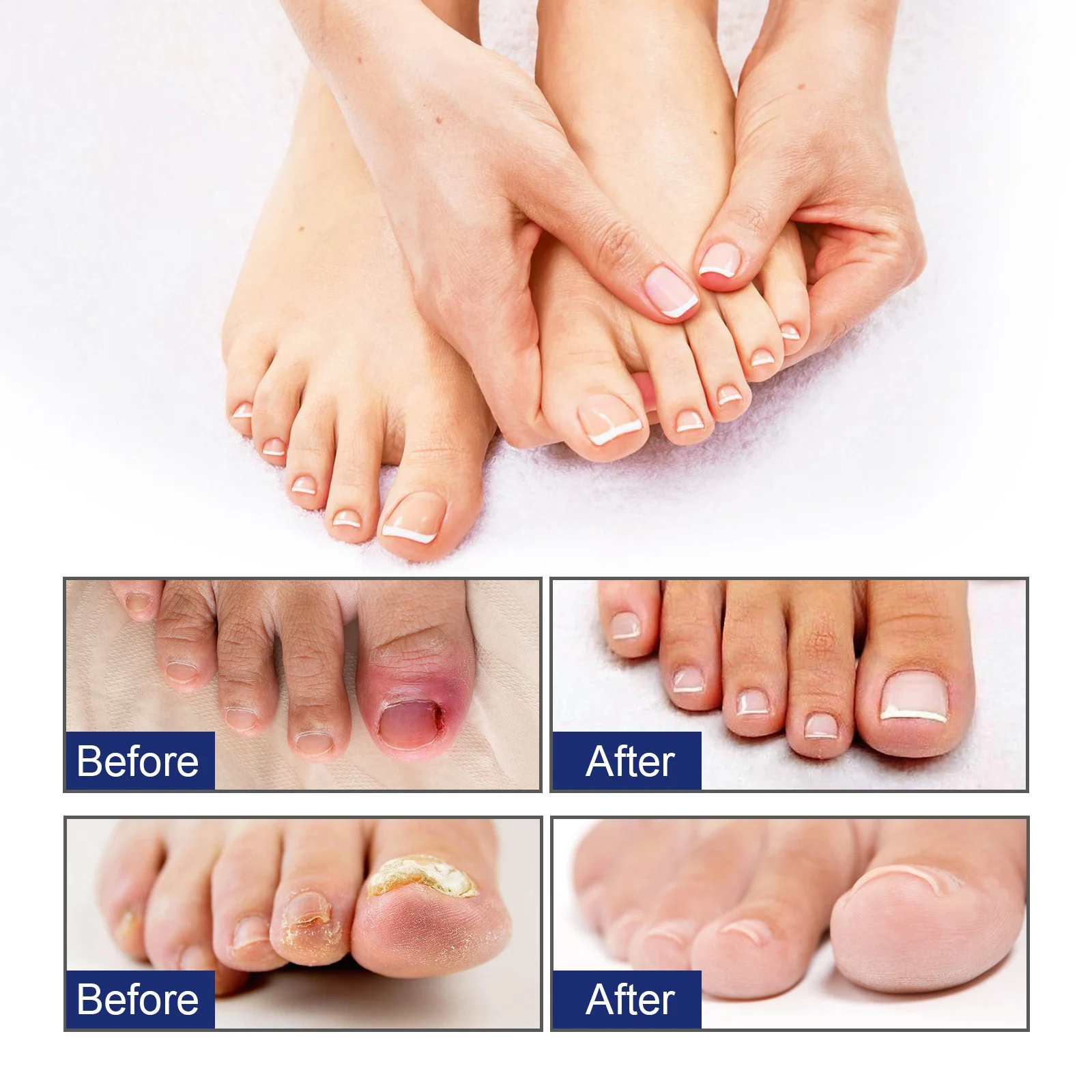 West Month Nail Care Liquid for Softening, Pain Relief & Disinfection 8 nail care liquid drops wes n4bpdwsc desc 8