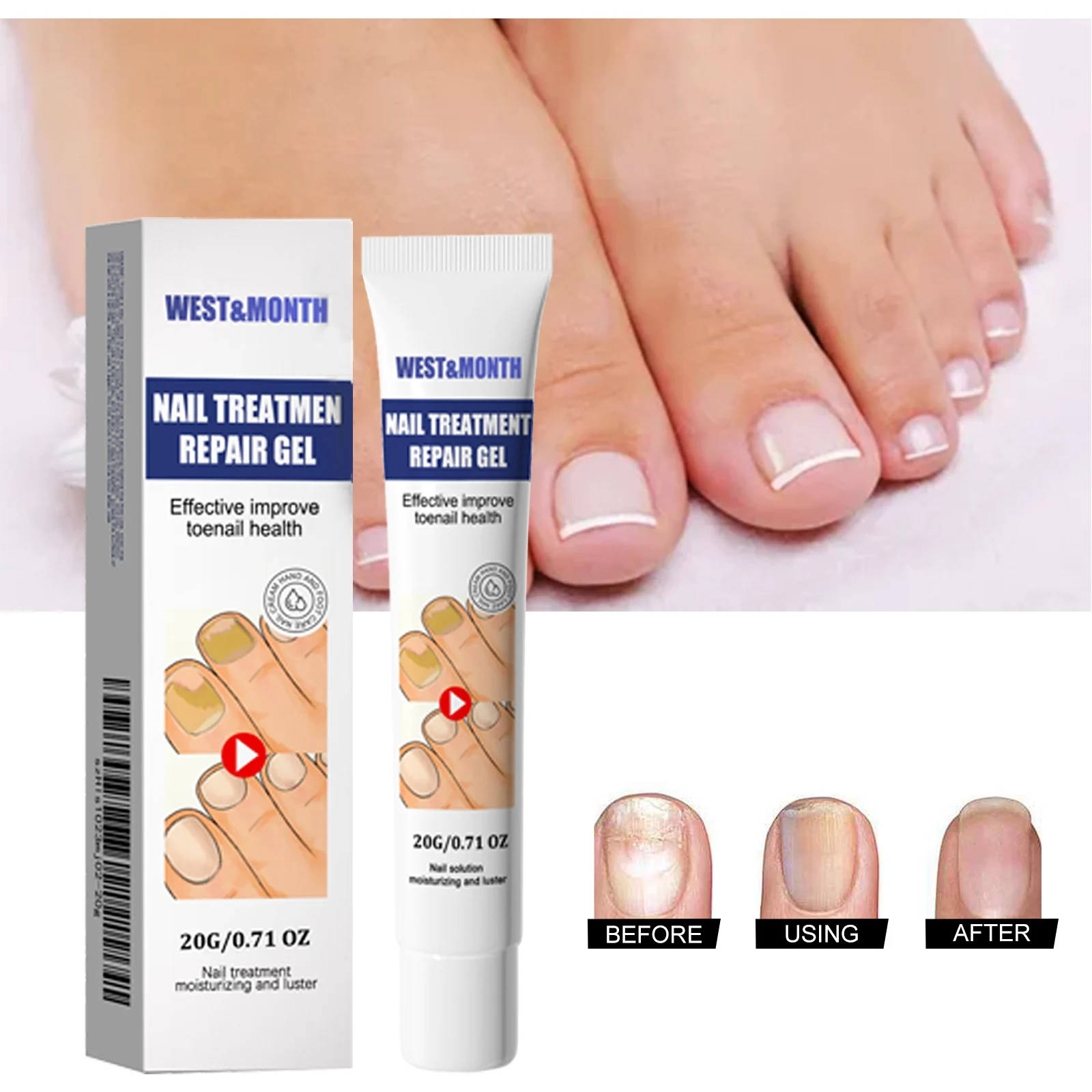 Nail Repair Treatment Gel 20g for Toenail Health, Moisturizing & Luster, Maximum Strength Formula 2 nail repair treatment gel 20g wes pteyn2g6 desc 2
