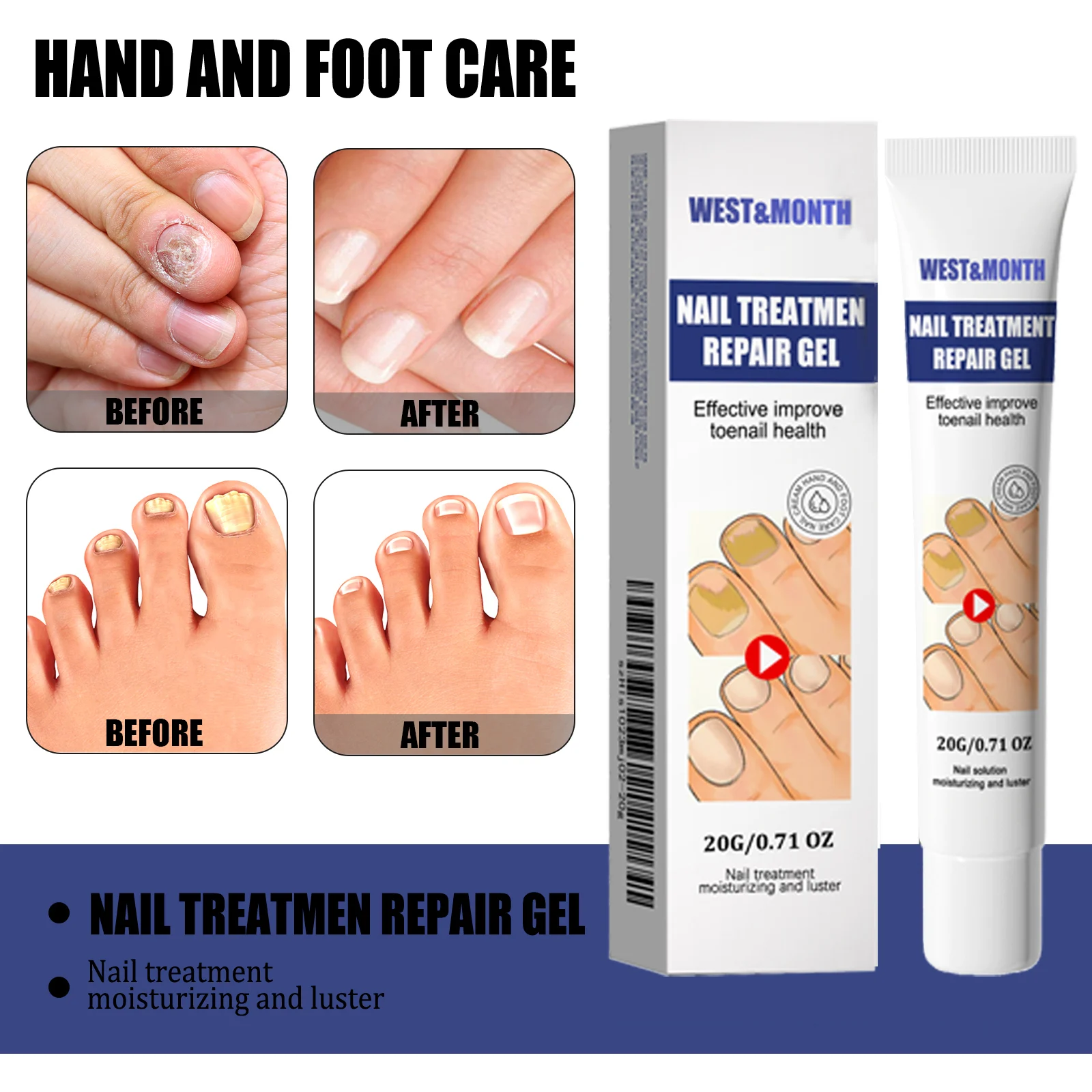 Nail Repair Treatment Gel 20g for Toenail Health, Moisturizing & Luster, Maximum Strength Formula 7 nail repair treatment gel 20g wes pteyn2g6 desc 7