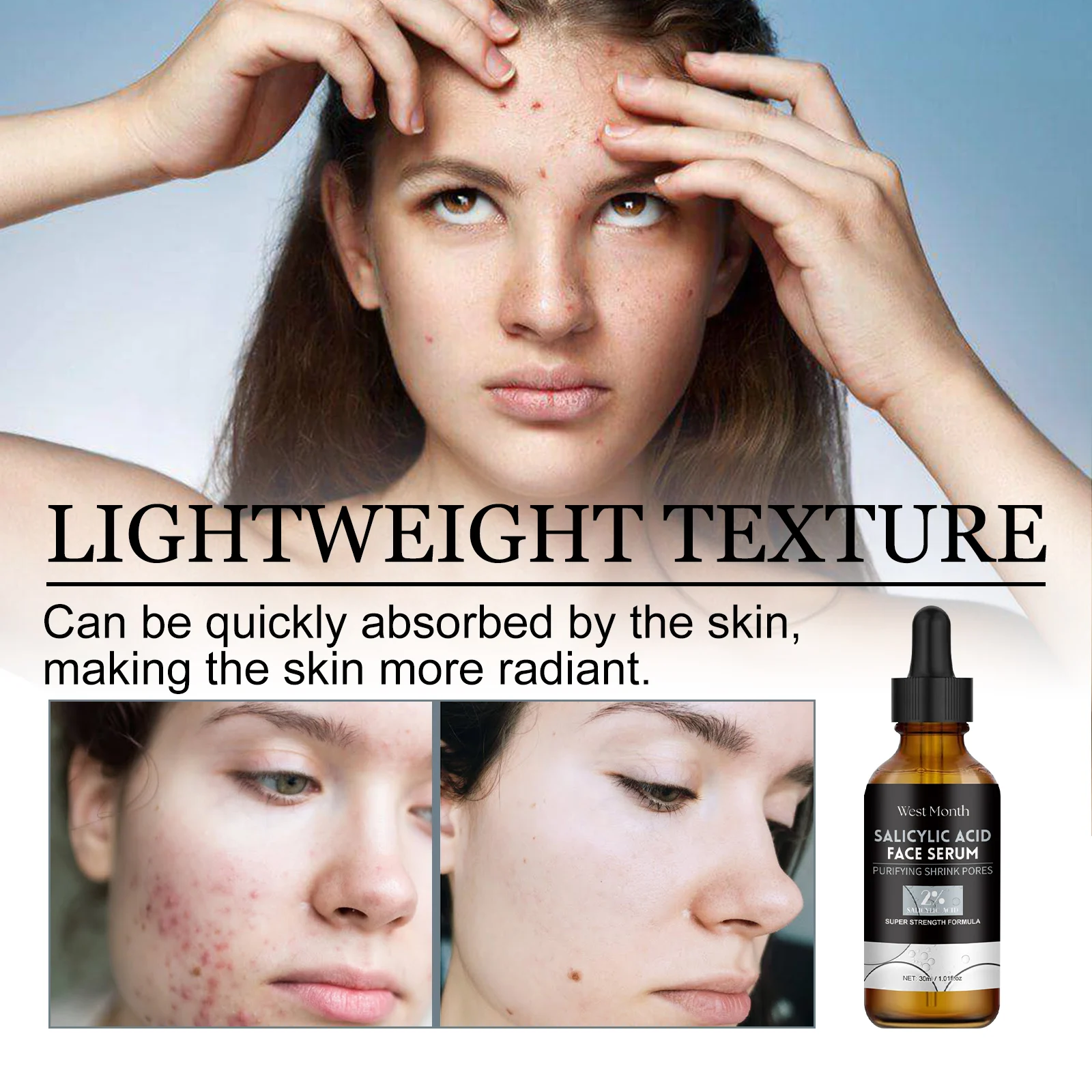 West Month Salicylic Acid Face Serum - Purifying, Pore Minimizing, Acne Treatment for All Skin Types 8 salicylic acid face serum wes wezs8s8h desc 8