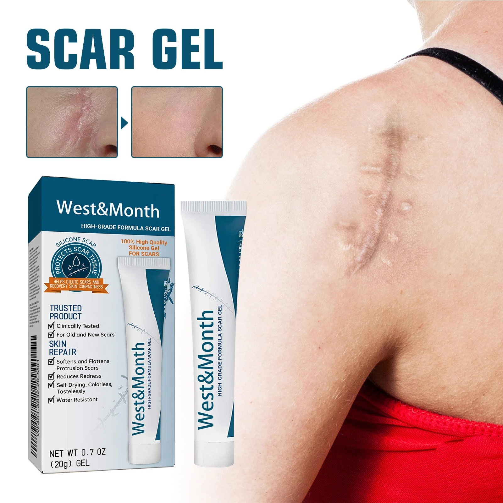 Scar Removal Gel 20g for Old & New Scars, Softens & Flattens Keloids, Post-Surgery & Acne 2 scar removal gel 20g wes jnzadc2q desc 2