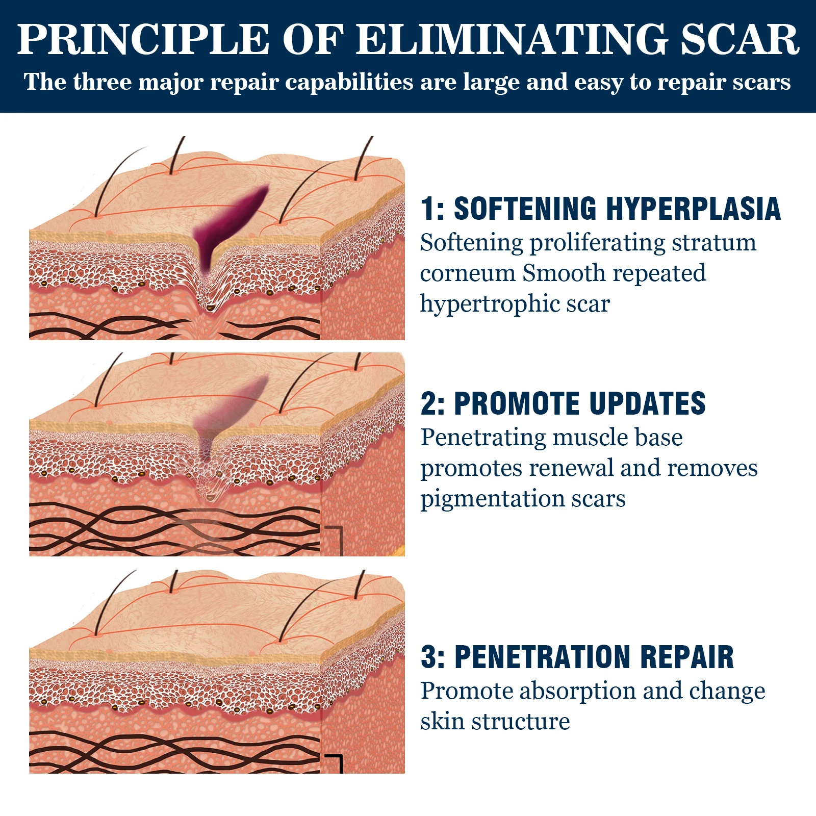 Scar Removal Gel 20g for Old & New Scars, Softens & Flattens Keloids, Post-Surgery & Acne 5 scar removal gel 20g wes jnzadc2q desc 5