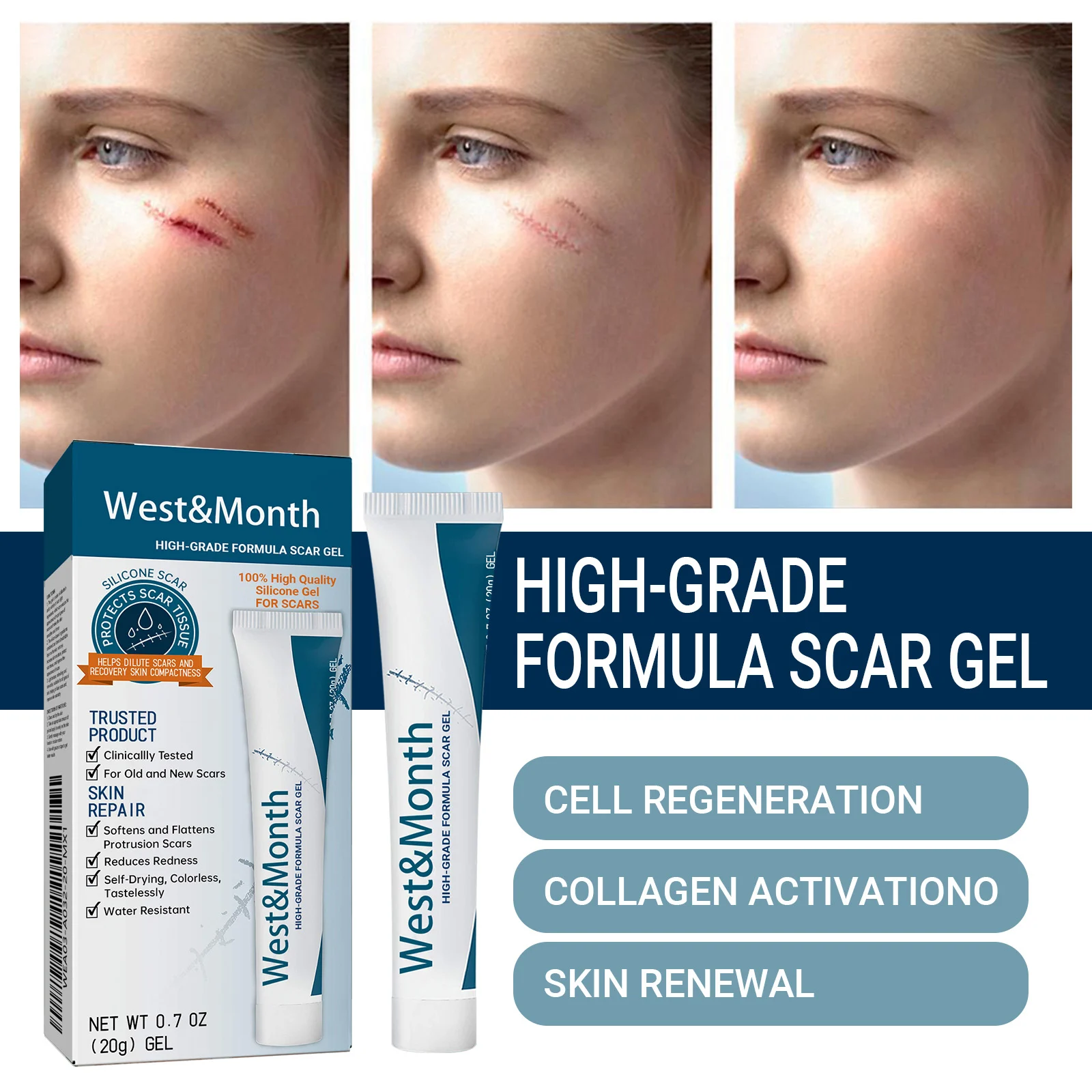 Scar Removal Gel 20g for Old & New Scars, Softens & Flattens Keloids, Post-Surgery & Acne 7 scar removal gel 20g wes jnzadc2q desc 7