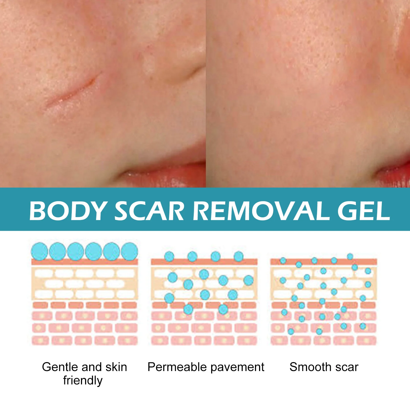 Scar Removal Gel with Centella & Retinol to Repair & Smooth Skin 5 scar removal gel 30ml wes prgghnkp desc 5