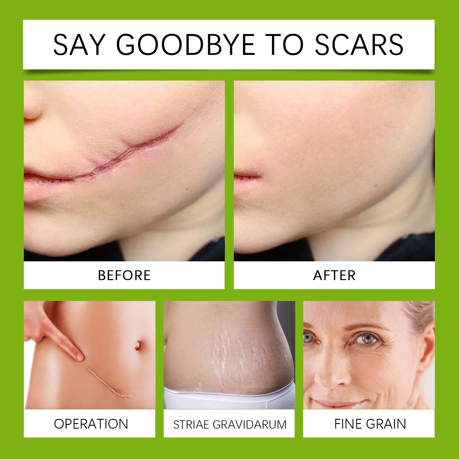 Scar Soothing Essence Repairs Skin, Reduces Stretch Marks & Wrinkles 30ml 9 scar soothing essence repair 30ml wes zcwkjy9k desc 9