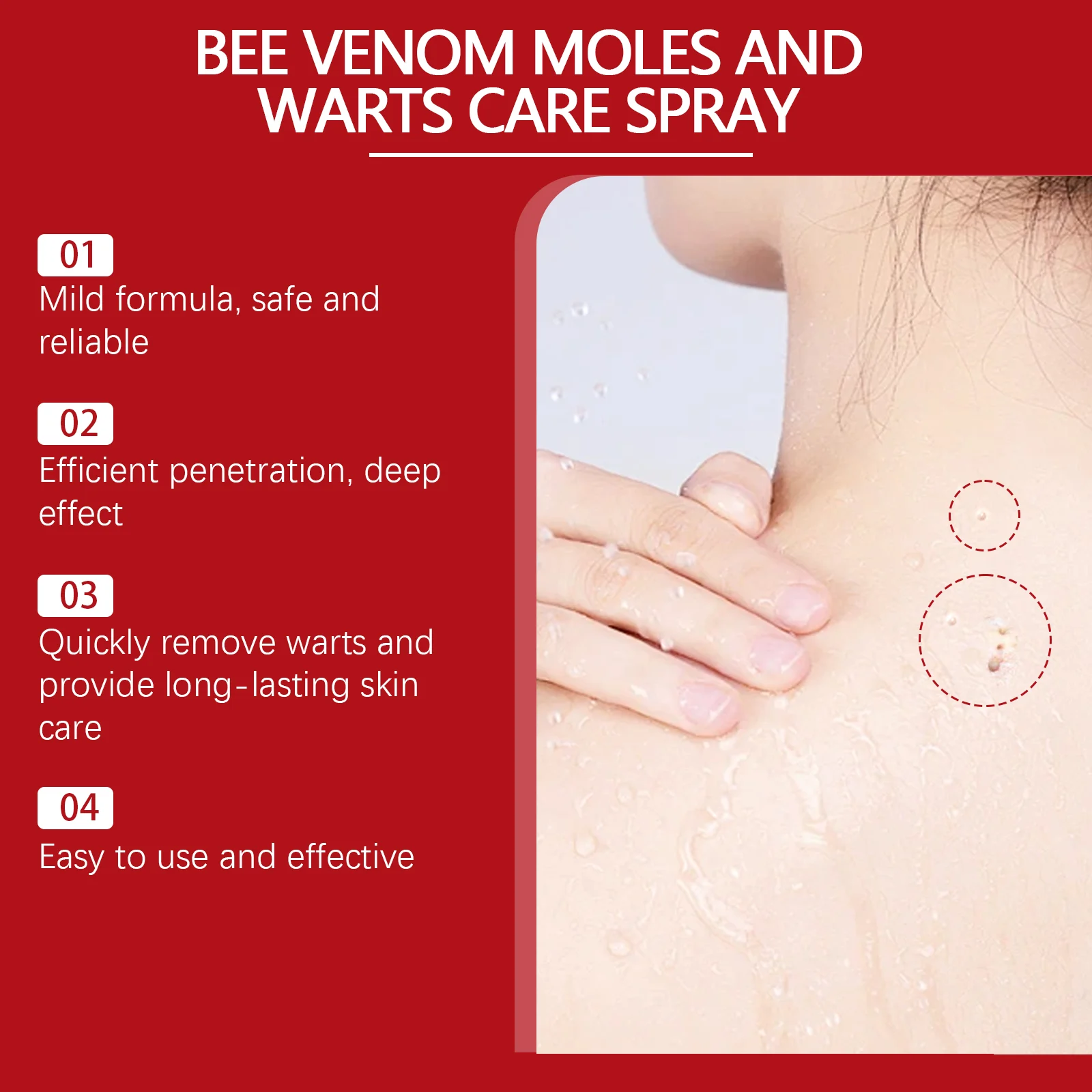 Skin Tags Rosehip Oil 30ml - Wart Removal Essence for Smooth Skin 5 skin tags rosehip oil wart removal 30ml wes 7pmd38t4 desc 5