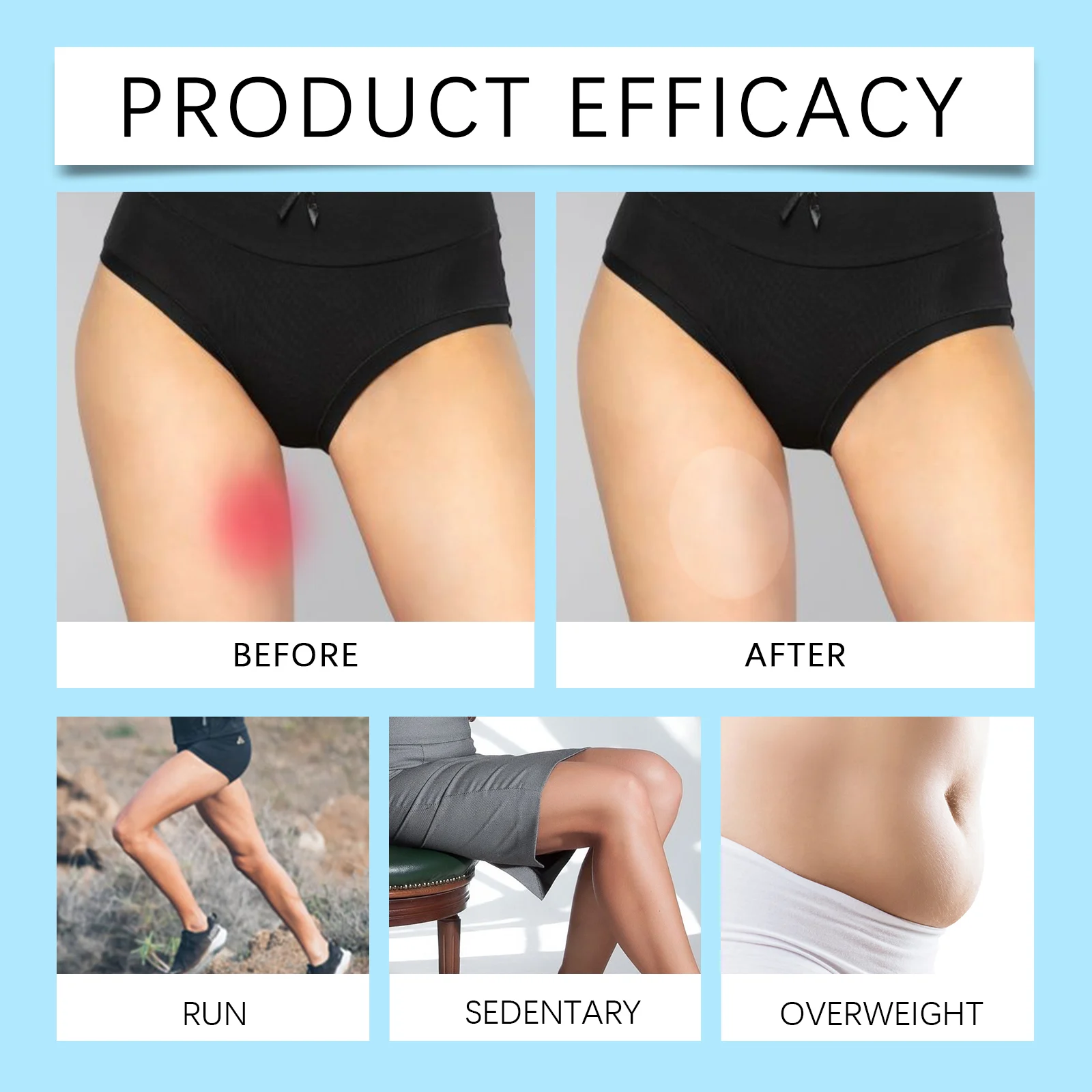 Thigh Anti-Chafing Patch Invisible Breathable Elastic Friction Protection 9 thigh anti chafing patch invisible breathable elastic wes r8w6rgk2 desc 9