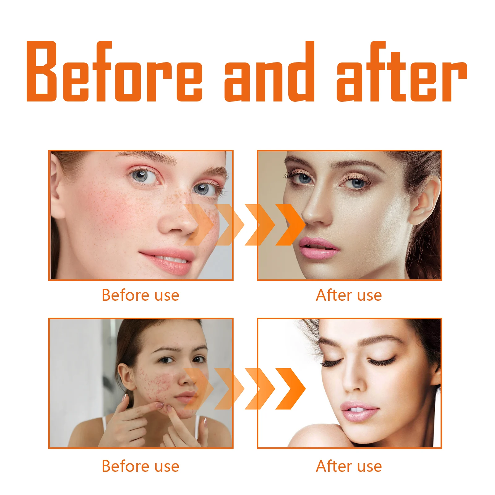 West Month Turmeric Toner for Dark Spots, Hydrating Facial Toner for Glowing Skin 10 turmeric dark spot toner wes j5jfmp5v desc 10