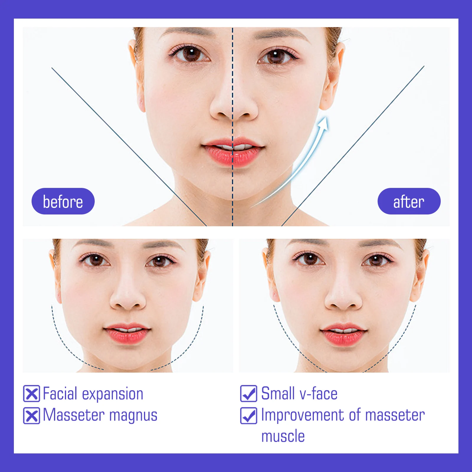 V-Shaped Face Lifting Patches Facial Firming Anti-Aging Slimming Tape 8 v shaped face lifting patches facial firming slimming tape wes j4gyg3mn desc 8