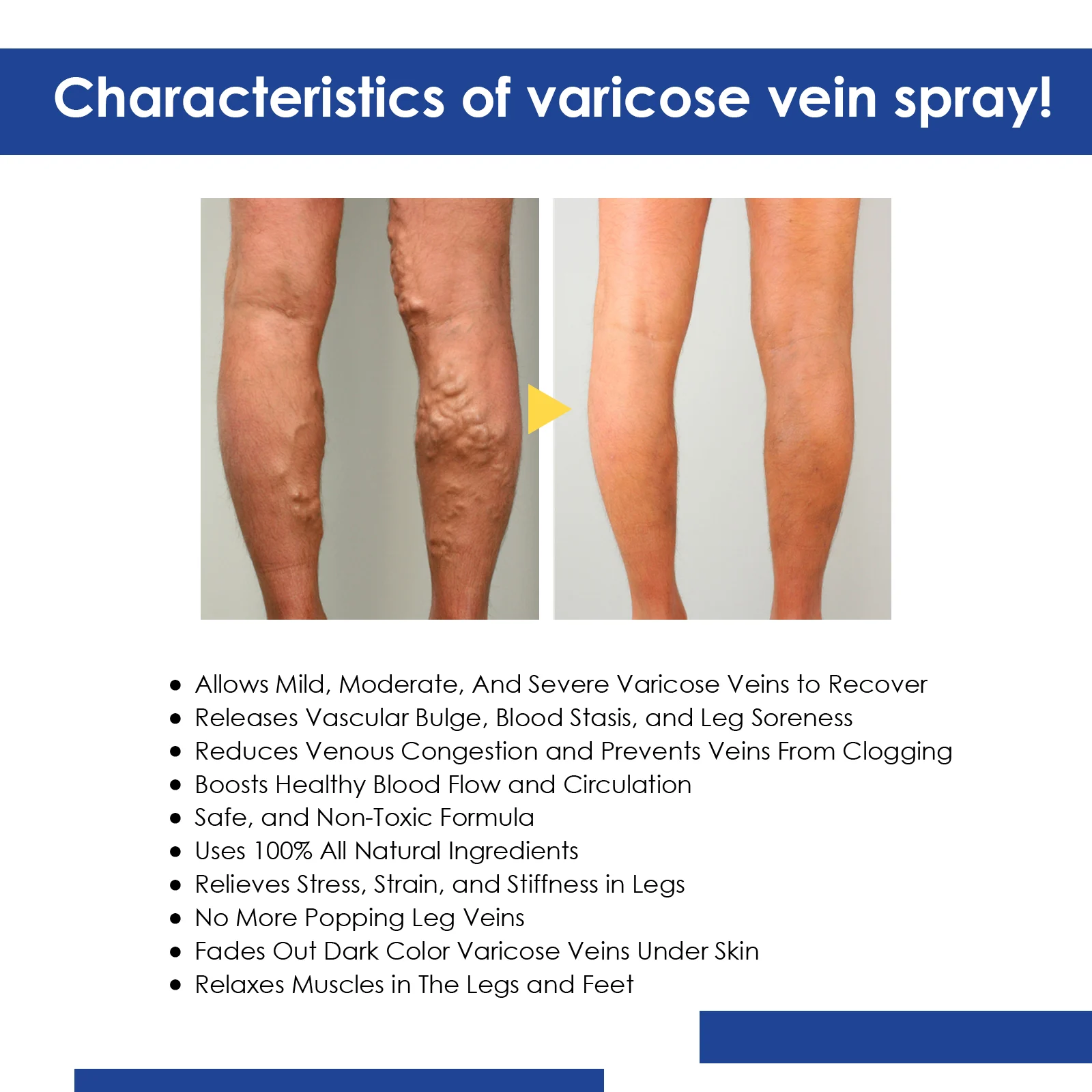 West Month Varicose Vein Spray - Improves Circulation, Reduces Spider & Varicose Veins 3 varicose vein spray leg treatment wes nvzkx923 desc 4